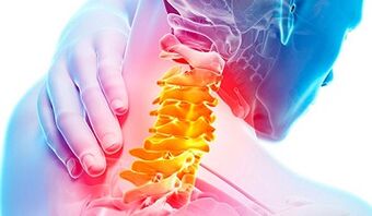 Segni di un'osteocondosi della colonna cervicale