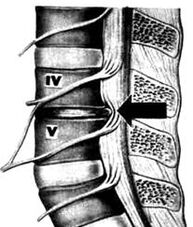 X -RAY Immagine del Dipartimento lombare dell'osteocondosi