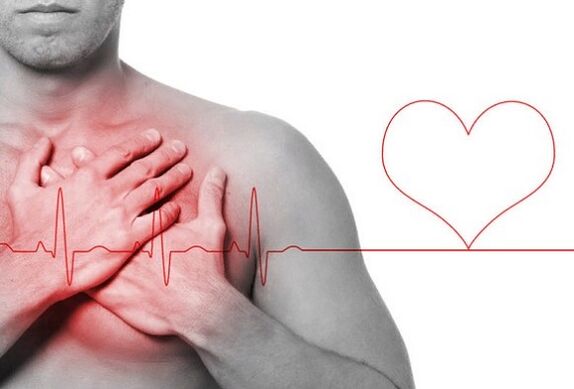 Attacco di cuore come causa di mal di schiena sotto la scapola sinistra